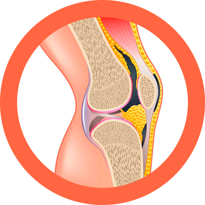 Hondroten - helyreállítja az ízületeket és az izmokat