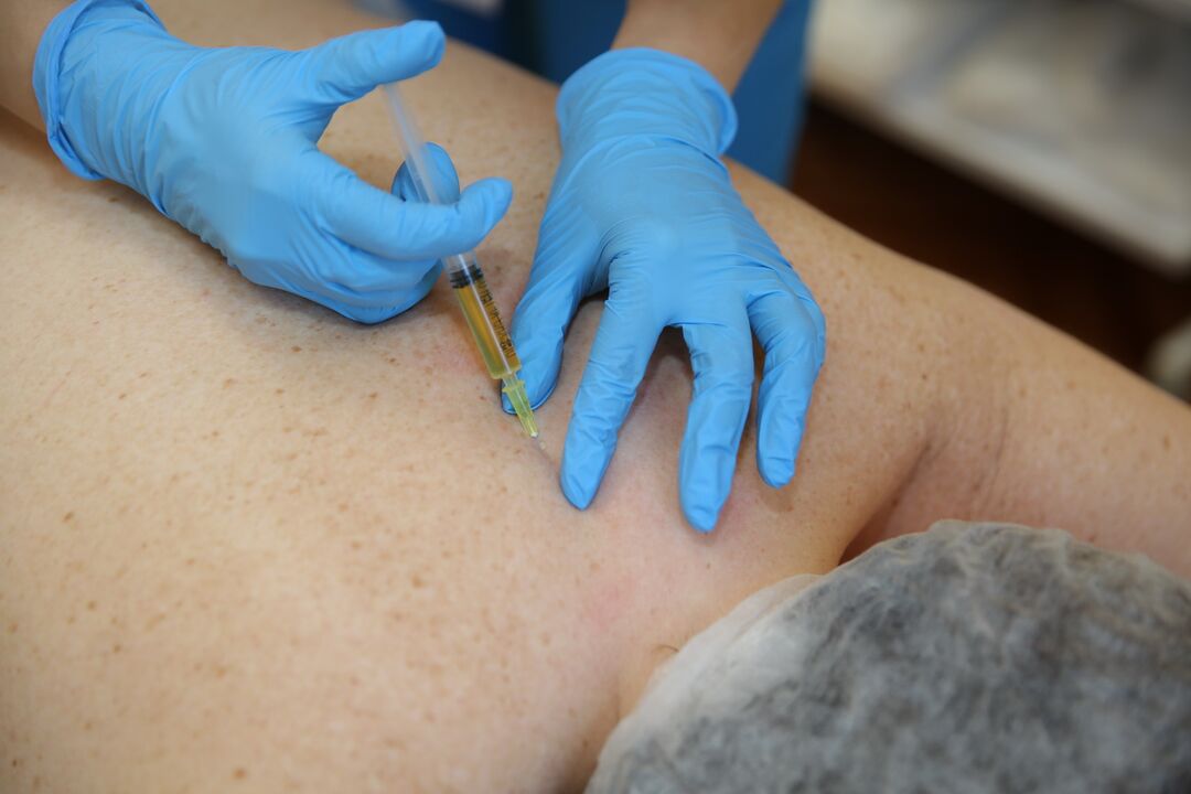 chondroprotectors injekciók a hátba