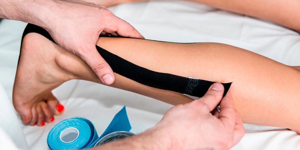 Taping deformáló arthrosis esetén - az ízület rögzítése ragasztószalaggal