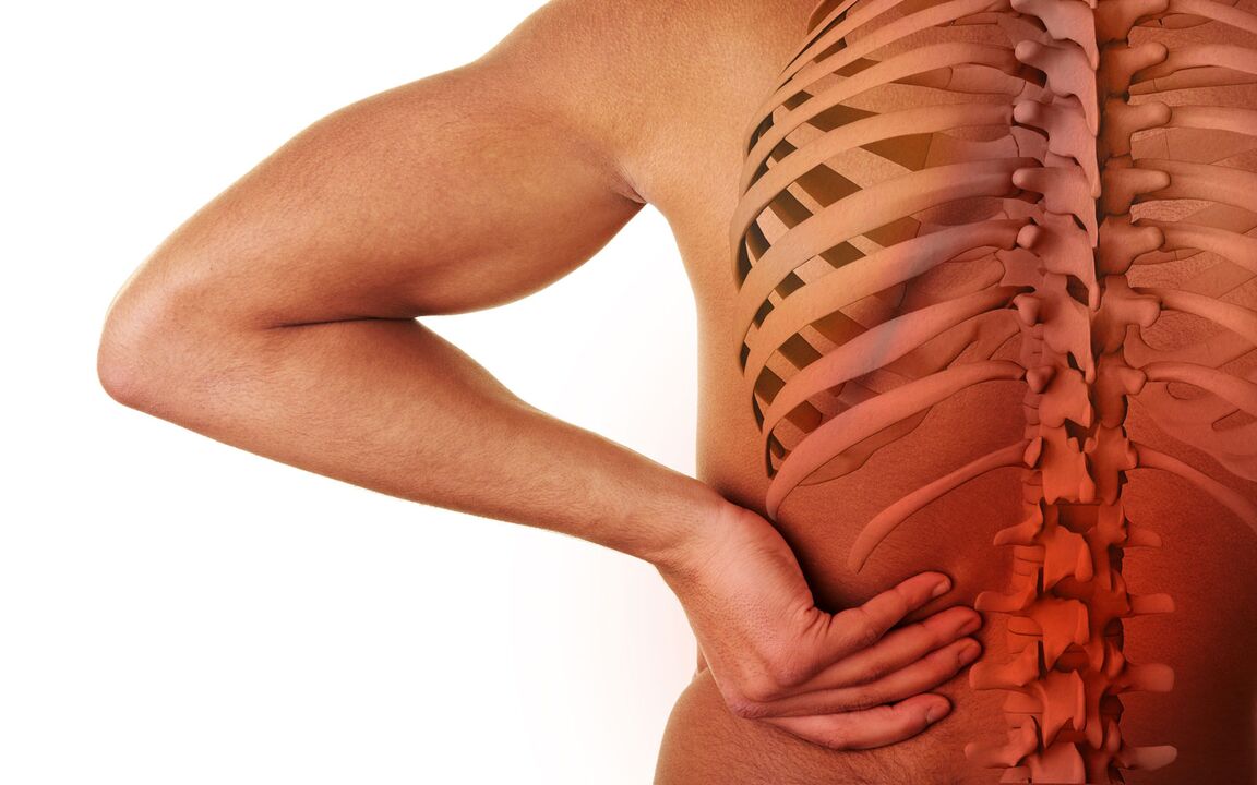 ágyéki osteochondrosis tünetei